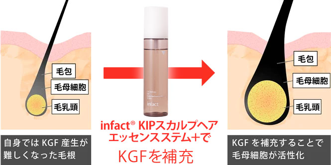 男性向け】KIPスカルプヘアエッセンス｜AGA・薄毛治療の【聖心毛髪再生外来】